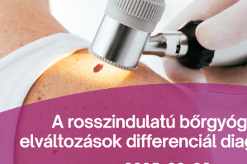 Szakmai Nap - A rosszindulatú bőrgyógyászati elváltozások differenciál diagnosztikája